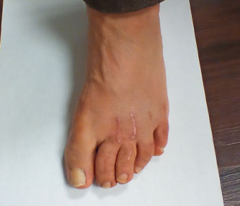 After