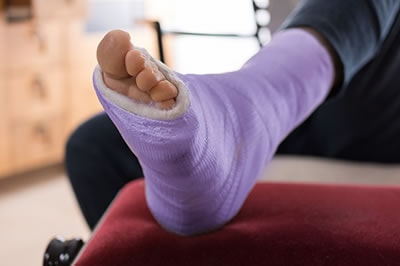 Foot and ankle fractures treatment in the Los Angeles County, CA: Lancaster (Lake Los Angeles, Palmdale, Oban, Antelope Acres, Del Sur, Quartz Hill, Desert View Highlands, Leona Valley); Kern County, CA: Rosamond, Tehachapi, North Edwards; San Mateo County, CA: Roosevelt, and Riverside County, CA: Lakeview areas