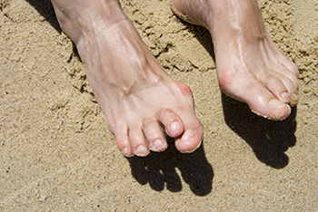 Hammertoe treatment in the Los Angeles County, CA: Lancaster (Lake Los Angeles, Palmdale, Oban, Antelope Acres, Del Sur, Quartz Hill, Desert View Highlands, Leona Valley); Kern County, CA: Rosamond, Tehachapi, North Edwards; San Mateo County, CA: Roosevelt, and Riverside County, CA: Lakeview areas
