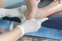 When to See a Podiatrist for Wound Care