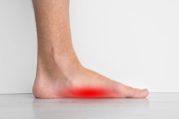 Surgery Options for Flat Feet