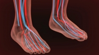 Symptoms and Causes of Poor Circulation in the Feet